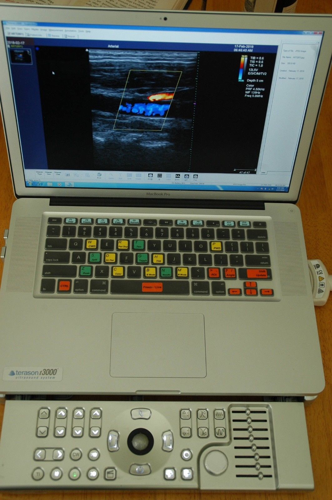 Macbook Pro Terason T3000 with linear 7L3 or 12L5 Transducer, like Siemens P50 DIAGNOSTIC ULTRASOUND MACHINES FOR SALE