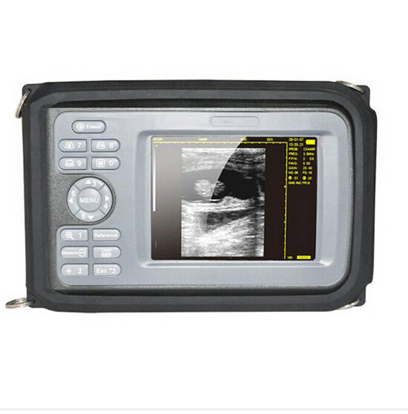 Portable Ultrasound Machine Scanner Ultrasound Device Convex Human Pregnancy A+ DIAGNOSTIC ULTRASOUND MACHINES FOR SALE