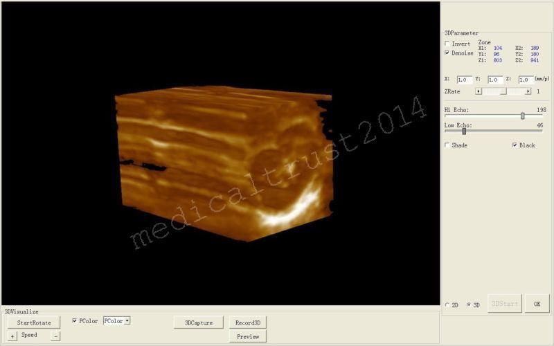 Free 3D LCD Digital Ultrasound System Scanner Machine+Convex Transvaginal Probes DIAGNOSTIC ULTRASOUND MACHINES FOR SALE