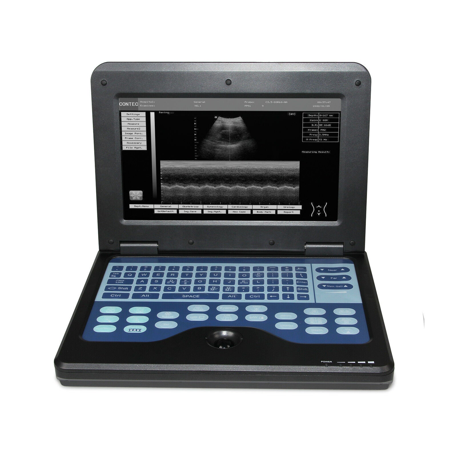 Portable Laptop Digital Ultrasound Scanner 3.5 Convex+ 6.5 Transvaginal 2 probes DIAGNOSTIC ULTRASOUND MACHINES FOR SALE