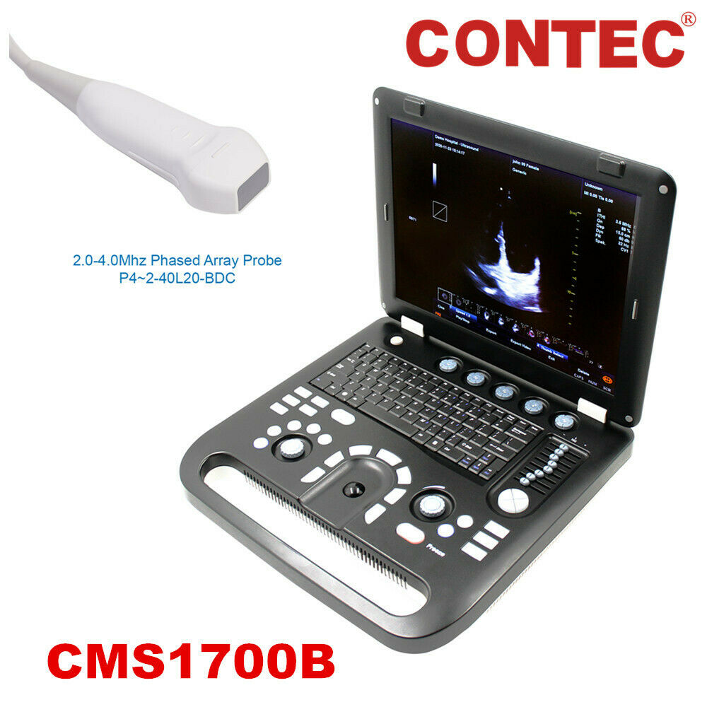 Color Doppler Ultrasound Scanner Cardiac Machine + Phased Array Probe Heart Exam DIAGNOSTIC ULTRASOUND MACHINES FOR SALE
