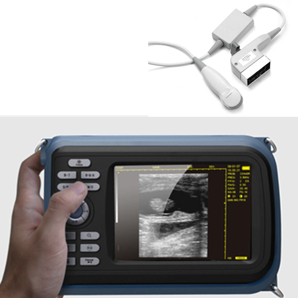 Digital Palm Smart Ultrasound Scanner +5Mhz Micro-convex Probe Human Cardiology 190891769312 DIAGNOSTIC ULTRASOUND MACHINES FOR SALE