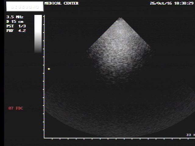 Esaote Biosound Megas/ MyLab ultrasound PA220 cardiac probe DIAGNOSTIC ULTRASOUND MACHINES FOR SALE