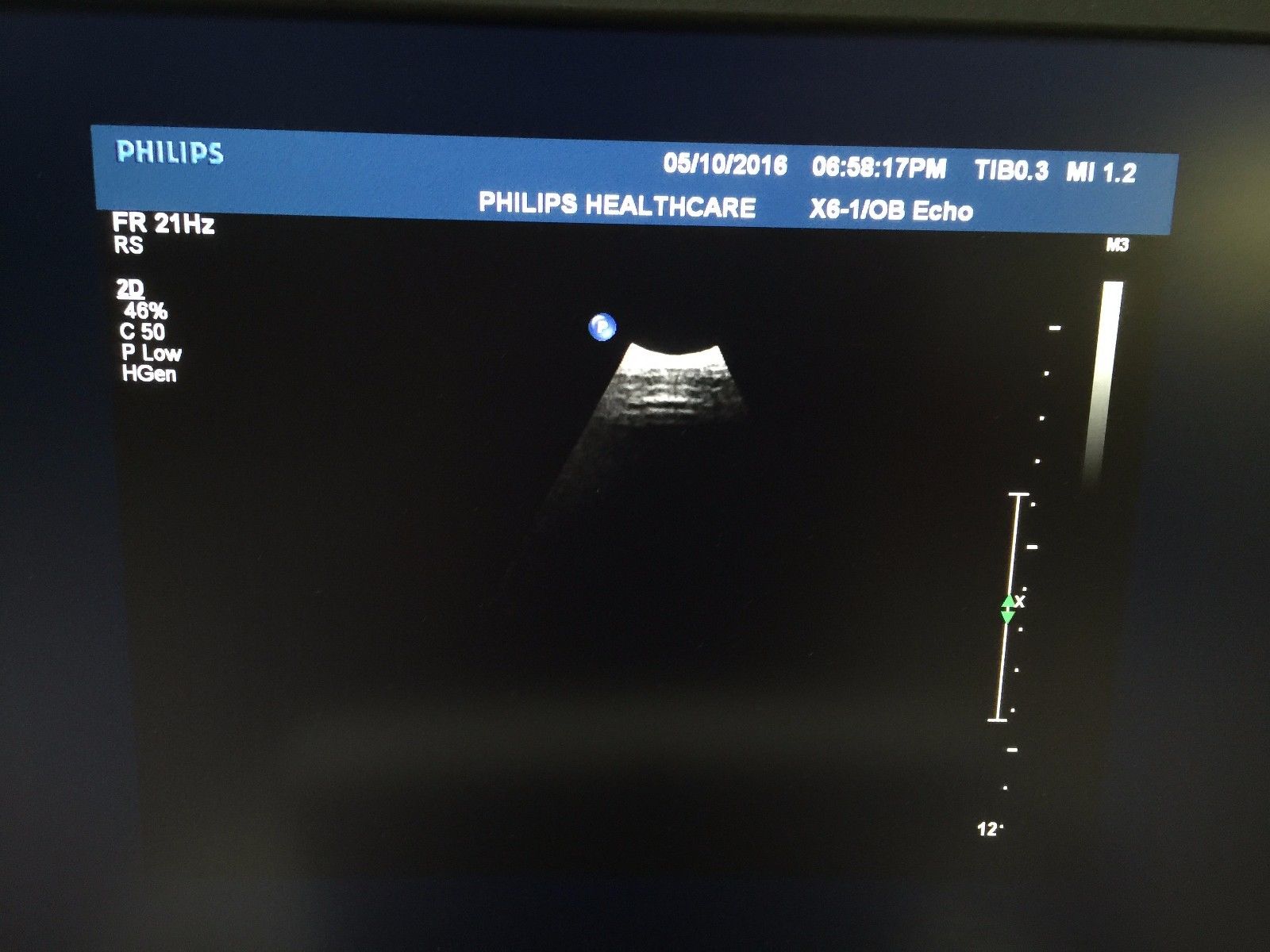 ultrasound monitor