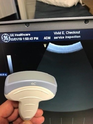 GE Vivid E Cardiac/Vascular/General Portable Ultrasound with 4 probes DIAGNOSTIC ULTRASOUND MACHINES FOR SALE
