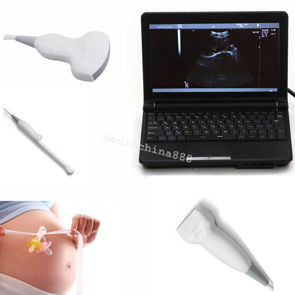 Newest Laptop Ultrasound Scanner +Convex+Linear+Transvaginal 3 Probes +Free Box DIAGNOSTIC ULTRASOUND MACHINES FOR SALE
