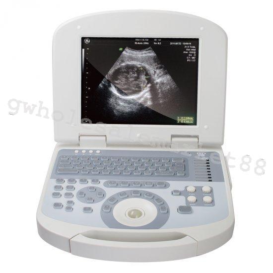 USA Digital Medical Ultrasound Machine Scanner Convex probe 3D Image Pregnancy 190891393838 DIAGNOSTIC ULTRASOUND MACHINES FOR SALE