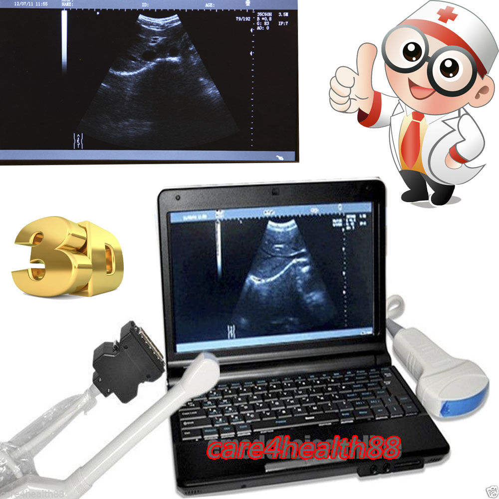 Factory Price 3D Digital Ultrasound Scanner Machine Convex +Transvaginal Probe 190891912442 DIAGNOSTIC ULTRASOUND MACHINES FOR SALE