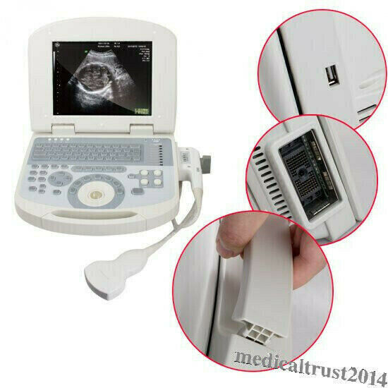 Portable Human Digital Laptop Ultrasound Scanner Machine System Convex Probe 3D DIAGNOSTIC ULTRASOUND MACHINES FOR SALE