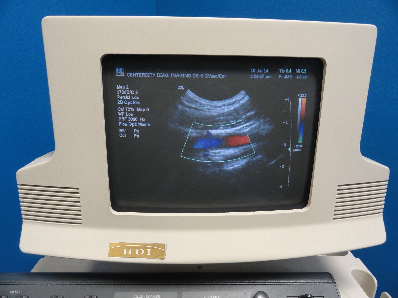 ATL C8-5 14R Micro-Convex Pediatric Small Parts Vascular MSK OB Probe (6865) DIAGNOSTIC ULTRASOUND MACHINES FOR SALE