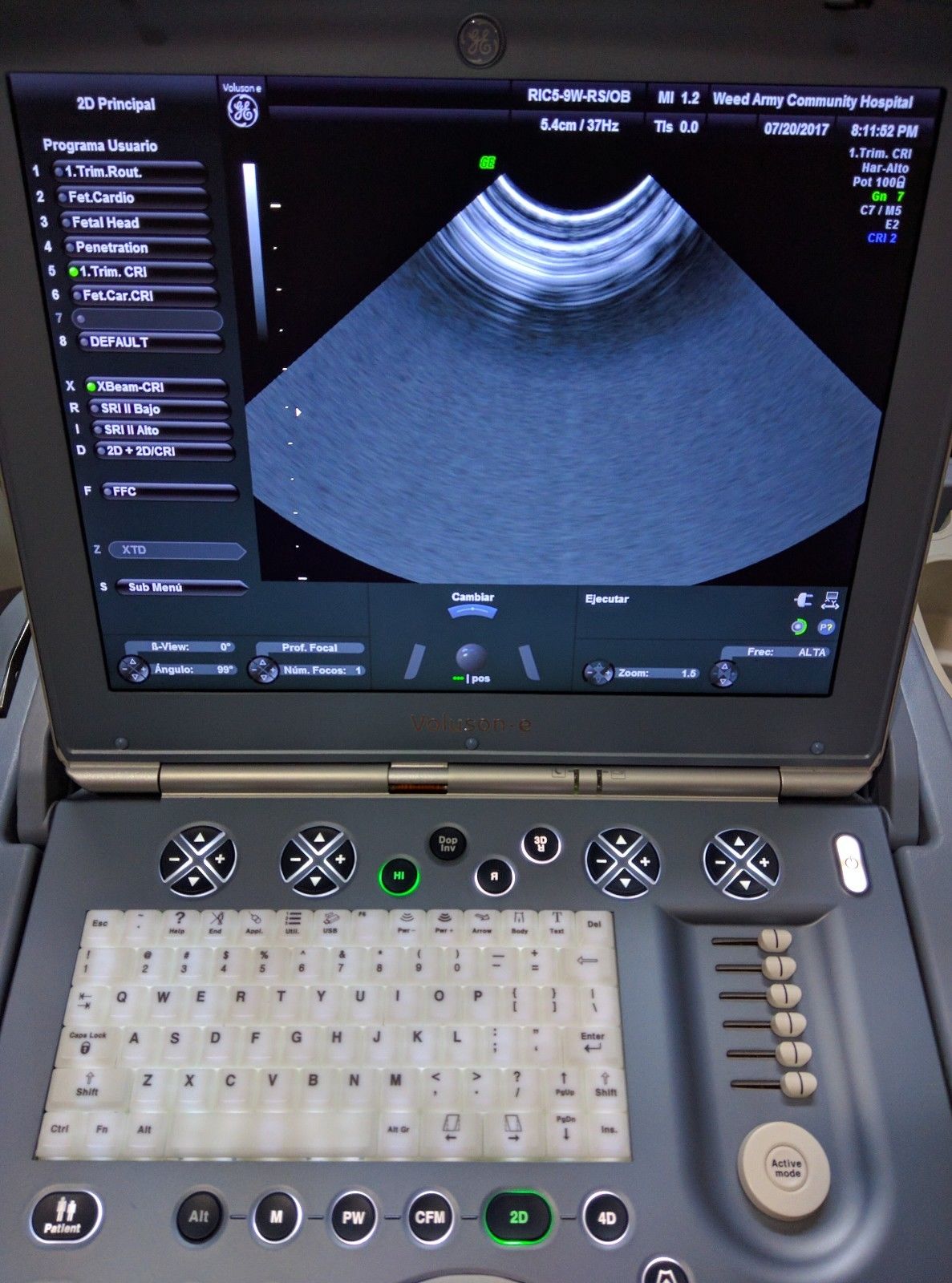 GE VOLUSON E BT08 3D/4D W/2 PROBES ULTRASOUND SYSTEM DIAGNOSTIC ULTRASOUND MACHINES FOR SALE