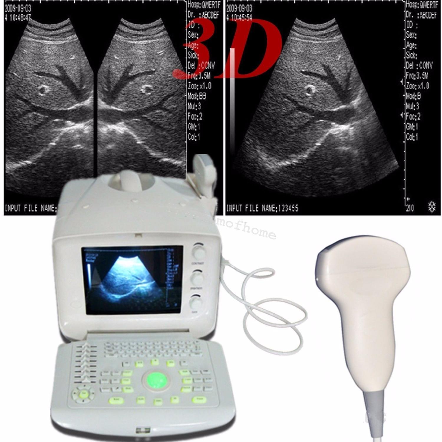 Full Digital Portable Ultrasound Scanner machine +Convex + Vignial 2 Probes+3D DIAGNOSTIC ULTRASOUND MACHINES FOR SALE
