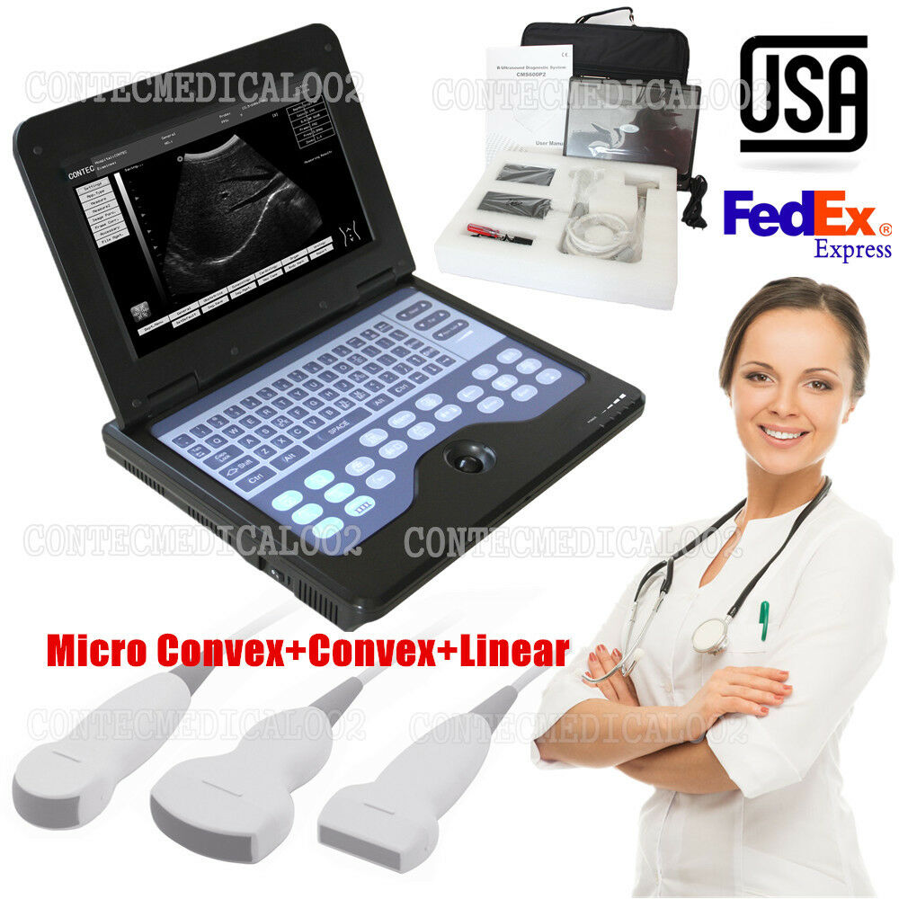 USA Portable ultrasound scanner laptop machine 3 Probes Convex Linear Cardiac DIAGNOSTIC ULTRASOUND MACHINES FOR SALE