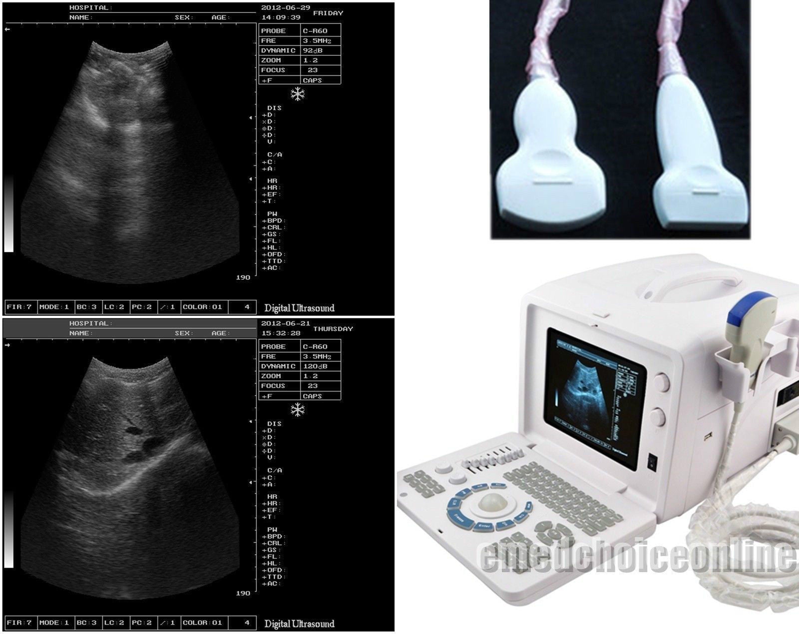 Digital Ultrasound machine Scanner System+Convex Linear Sensor Probe+3D Display 190891791764 DIAGNOSTIC ULTRASOUND MACHINES FOR SALE