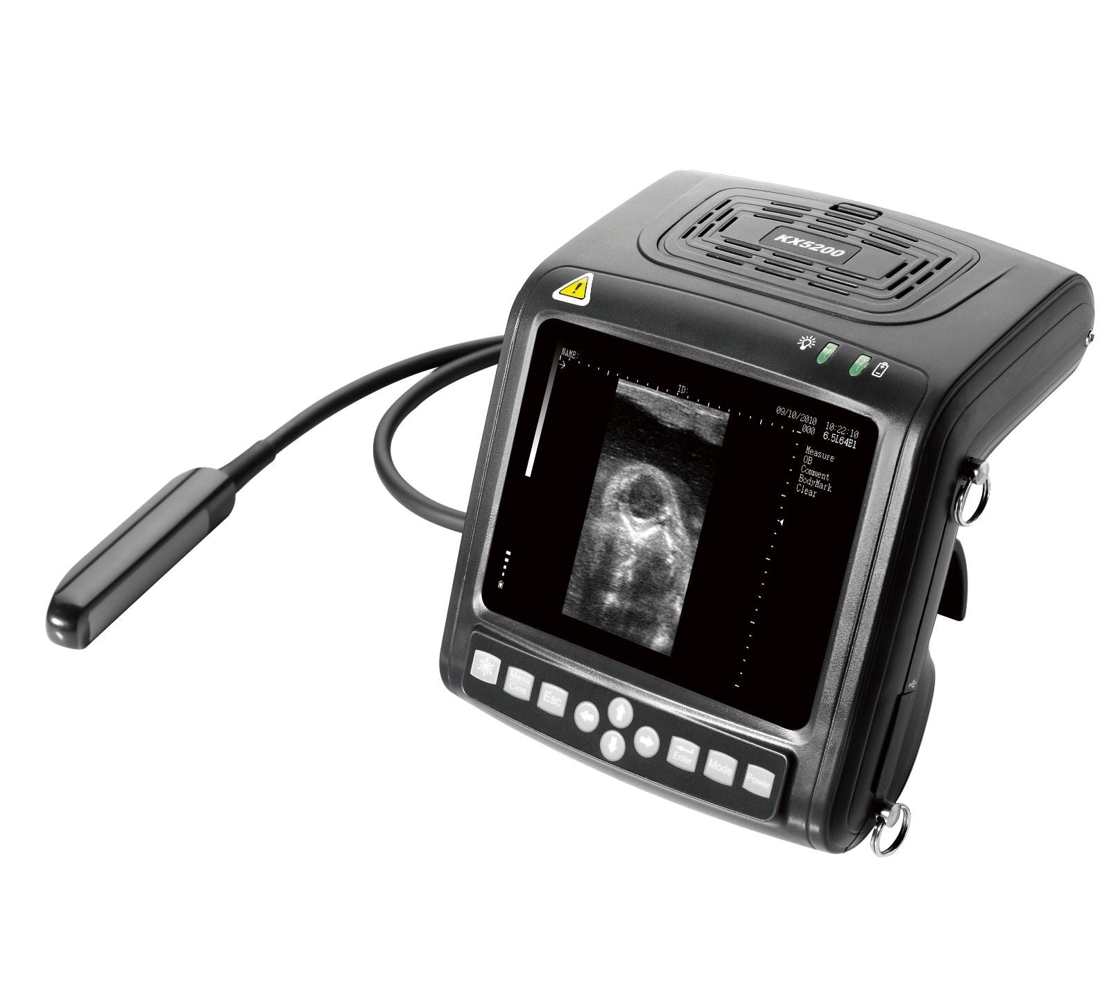 KX5200V Veterinary Wrist Ultrasound Scanner-Large Animal & Rectal Probe KeeboMed DIAGNOSTIC ULTRASOUND MACHINES FOR SALE