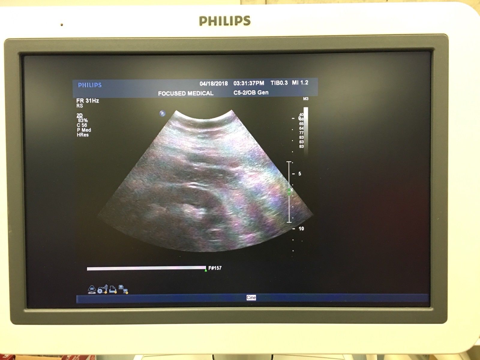 Phillips ATL C5-2 Ultrasound Probe / Transducer Demo Conditions DIAGNOSTIC ULTRASOUND MACHINES FOR SALE