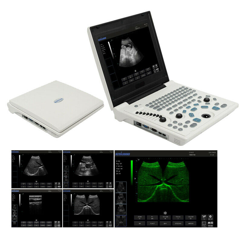Portable 12''LED Screen Full Digital Ultrasound Scanner + 3.5MHz Convex Probe DIAGNOSTIC ULTRASOUND MACHINES FOR SALE