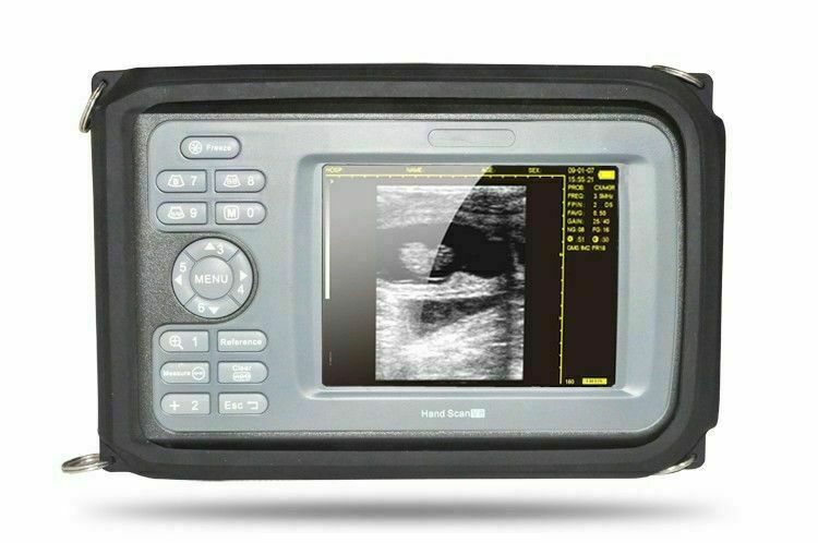 Handheld Ultrasound Scanner/Machine Convex Probe Abdominal Ultrasound Human Use DIAGNOSTIC ULTRASOUND MACHINES FOR SALE