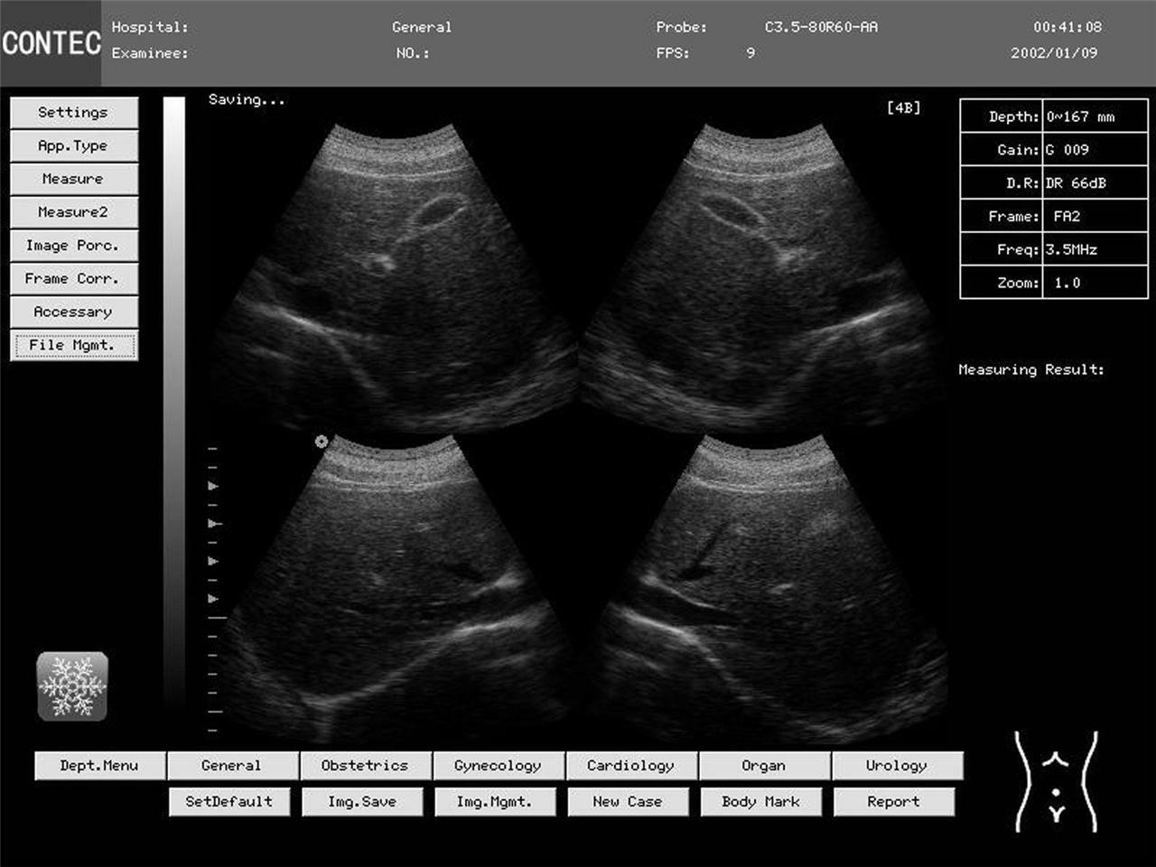 Newest Digital Portable Laptop Ultrasound Scanner Machine,7.5MHz Linear probe US 658126883672 DIAGNOSTIC ULTRASOUND MACHINES FOR SALE