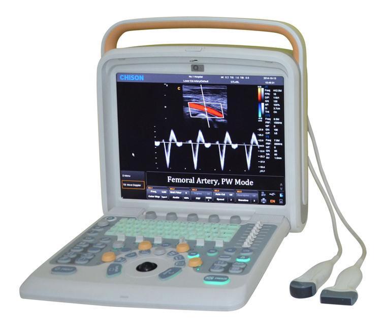 Color Doppler Ultrasound Chison Q5, 4D Probe-Obstetrics Gynecology New Warranty DIAGNOSTIC ULTRASOUND MACHINES FOR SALE