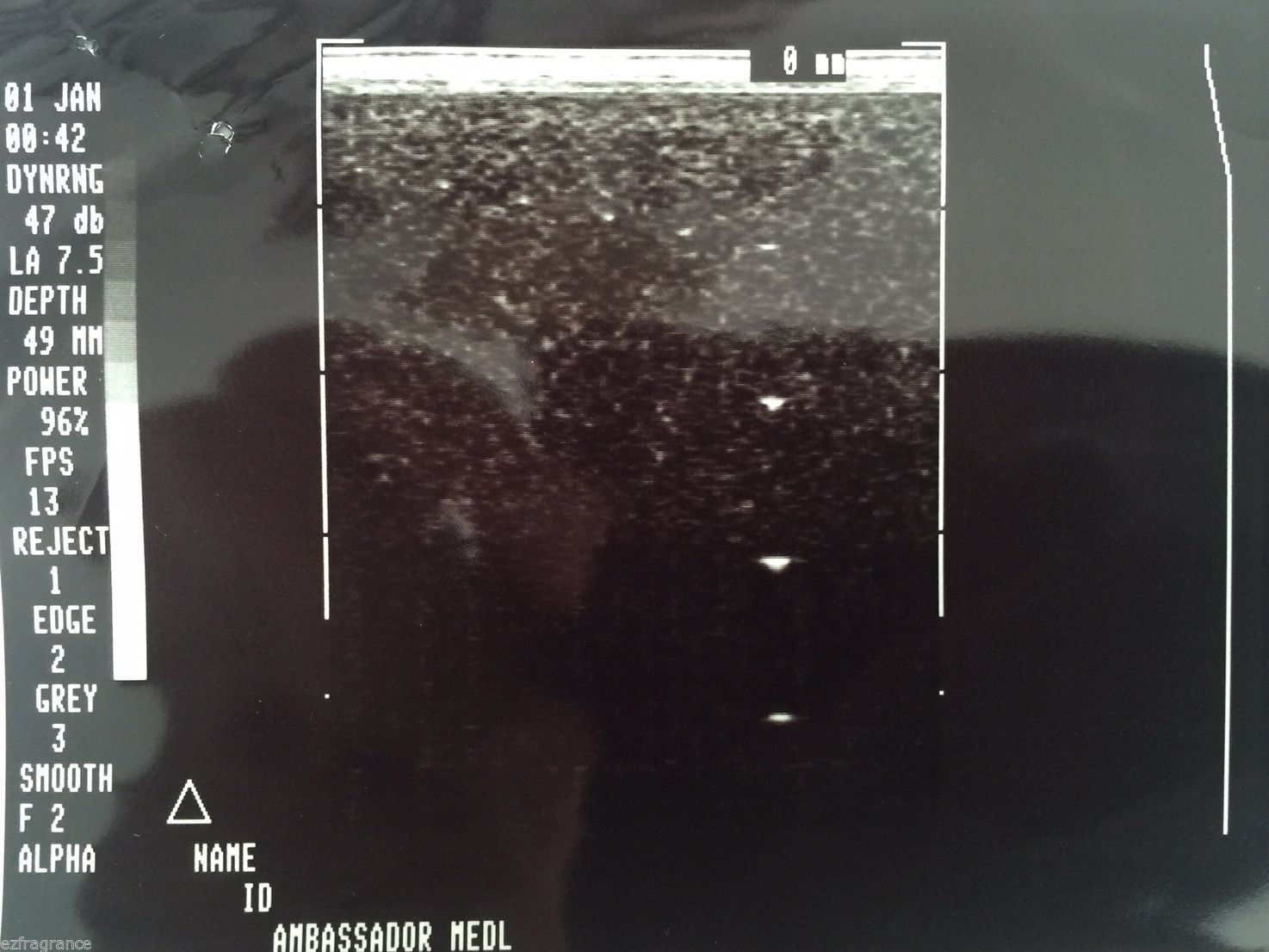ATL LA 7.5 MHz.HR Linear Array Ultrasound Probe / Transducer.USED full-tested DIAGNOSTIC ULTRASOUND MACHINES FOR SALE