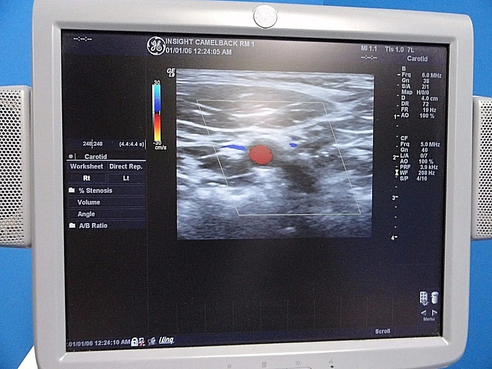GE 7L / 2302648 Linear Array Ultrasound Probe for Logiq & Vivid Series~13787 DIAGNOSTIC ULTRASOUND MACHINES FOR SALE