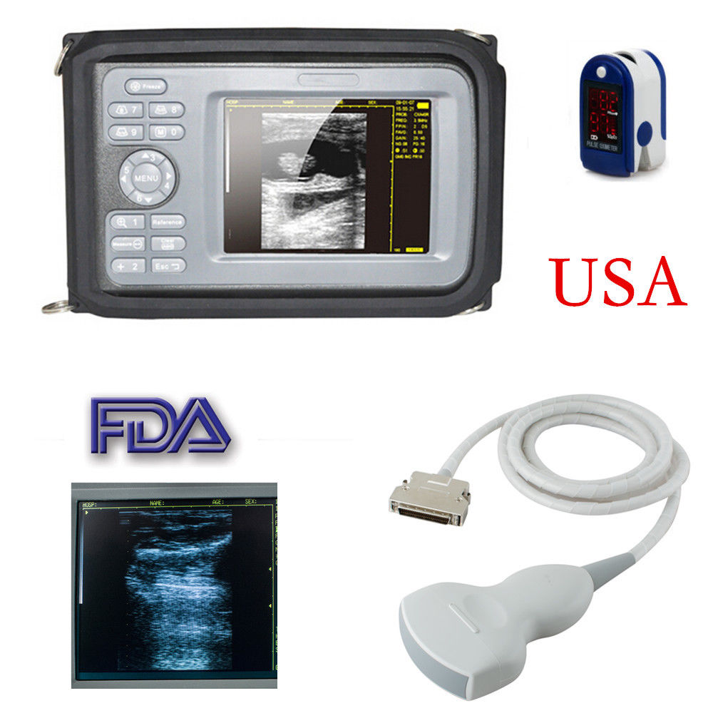 HandScan 5.5''Color Digital Ultrasound Scanner System+Convex Probe+Gift Oximeter DIAGNOSTIC ULTRASOUND MACHINES FOR SALE