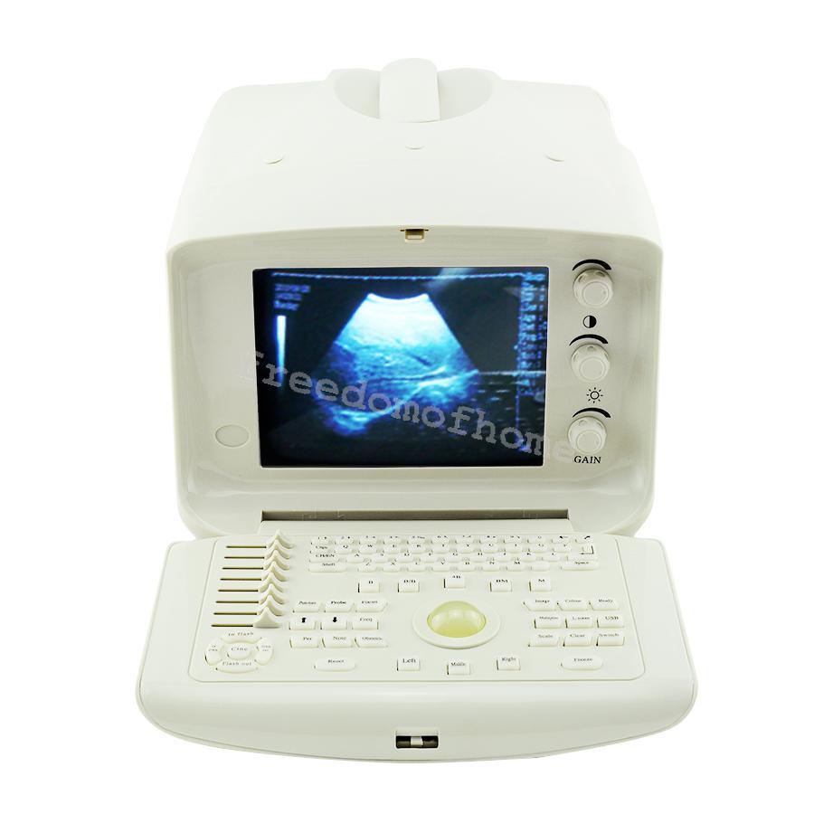 Full Digital Portable Ultrasound Scanner machine +Convex + Vignial 2 Probes+3D DIAGNOSTIC ULTRASOUND MACHINES FOR SALE