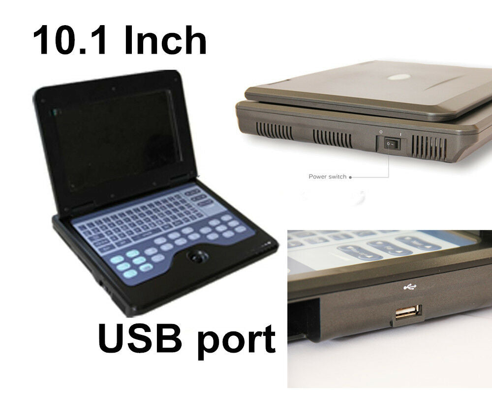 Portable Ultrasound Scanner Laptop Machine with 3 Probes,Convex/ Linear/ Cardiac DIAGNOSTIC ULTRASOUND MACHINES FOR SALE