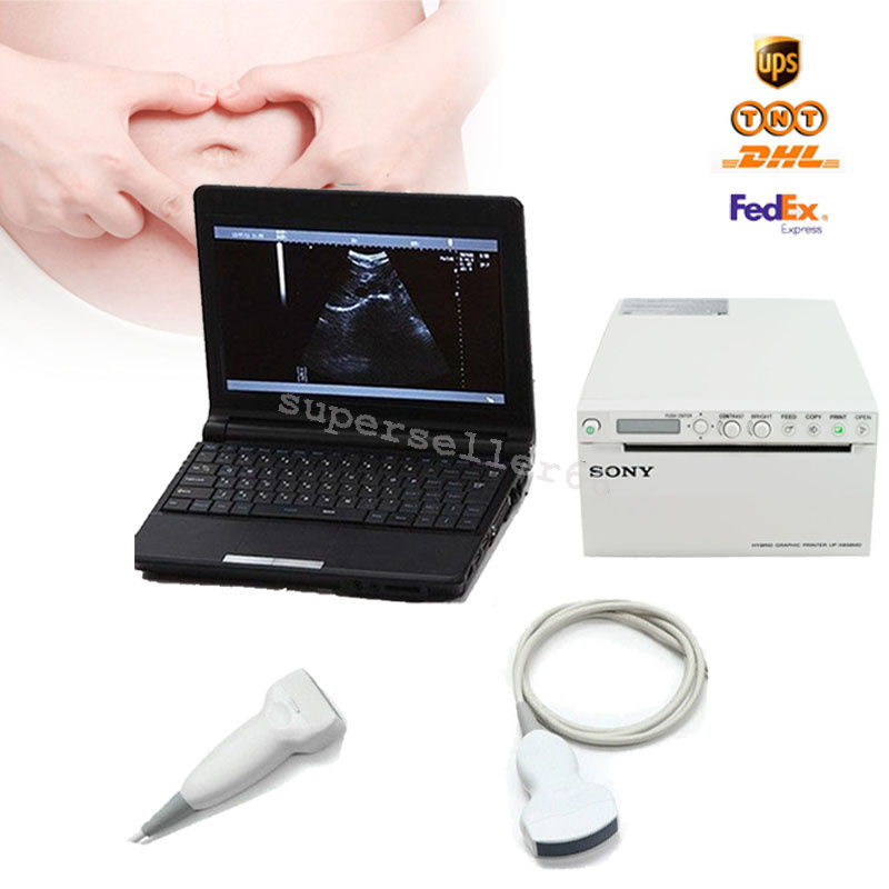Digital LCD Monitor Ultrasound Scanner+Convex Linear Probe+Sony UP-897MD Printer DIAGNOSTIC ULTRASOUND MACHINES FOR SALE