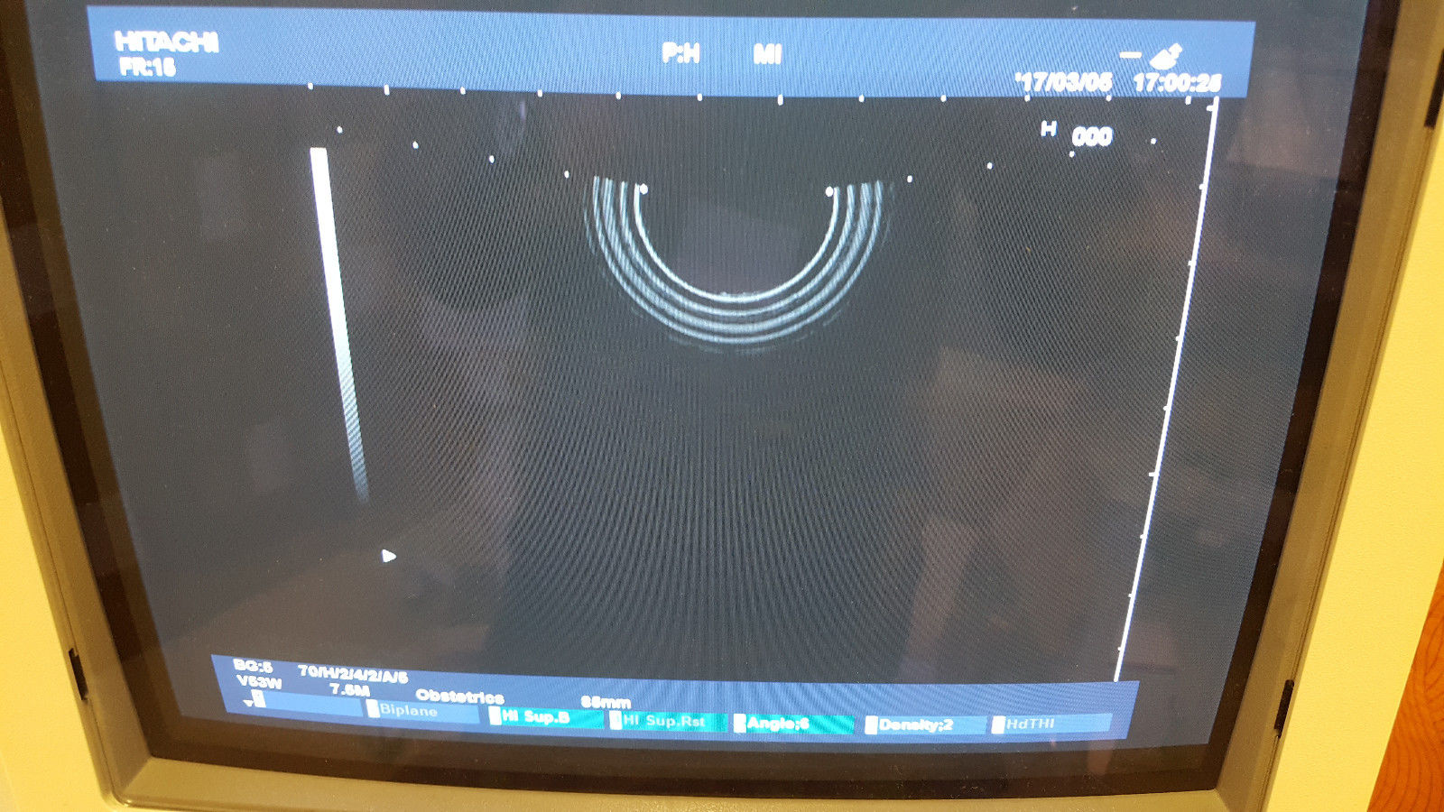 Hitachi EUP-V53W GYN ultrasound transducer DIAGNOSTIC ULTRASOUND MACHINES FOR SALE