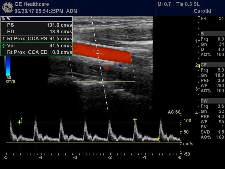 GE Logiq E9 with XDclear Ultrasound System DIAGNOSTIC ULTRASOUND MACHINES FOR SALE