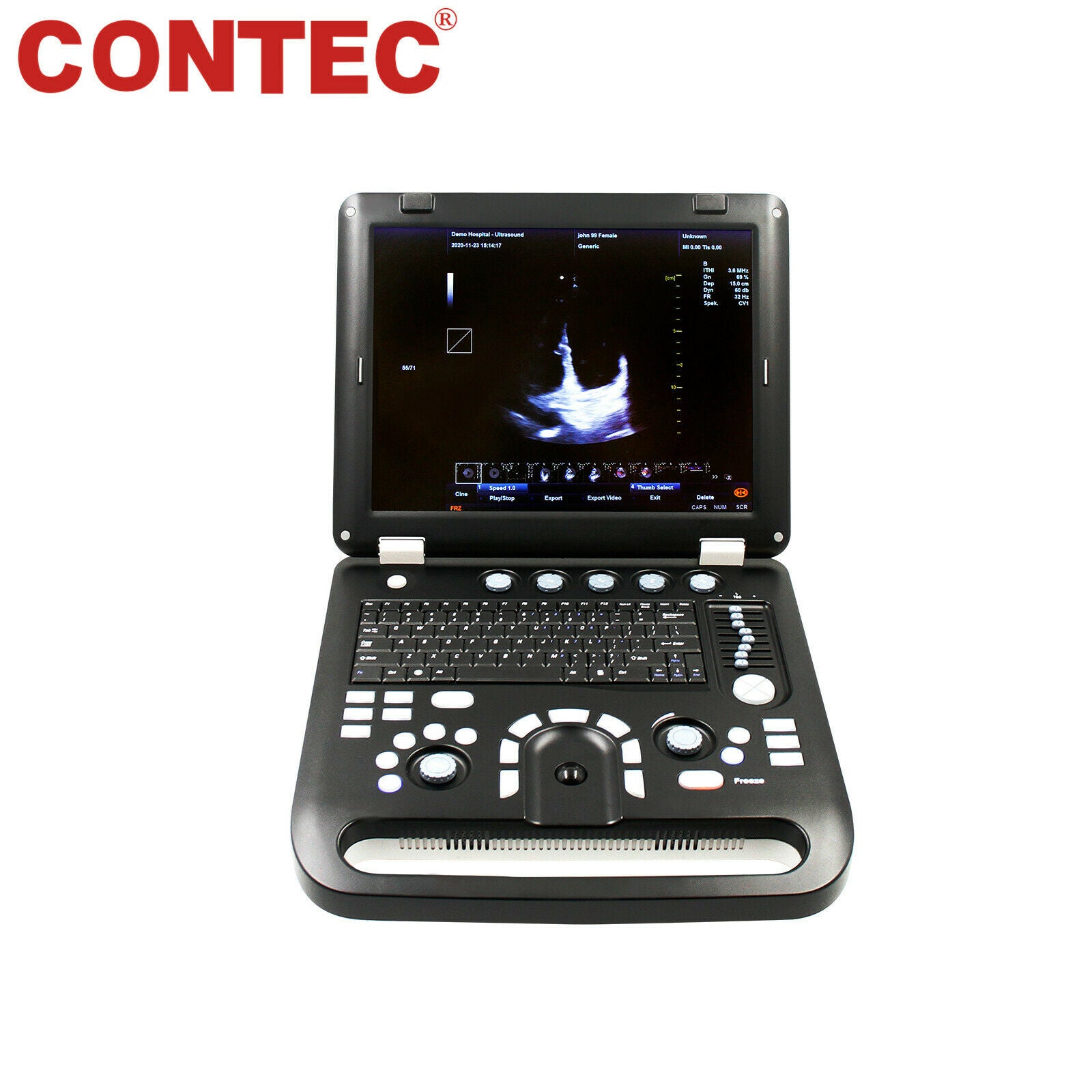 New Color Doppler Ultrasound Scanner Portable Laptop Machine with Rectal Probe DIAGNOSTIC ULTRASOUND MACHINES FOR SALE