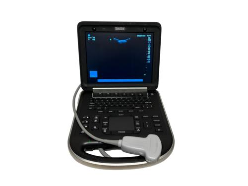 Sonosite Edge Portable Ultrasound 2015 & 3 probes P21x, P25x, C60x Refurbished DIAGNOSTIC ULTRASOUND MACHINES FOR SALE