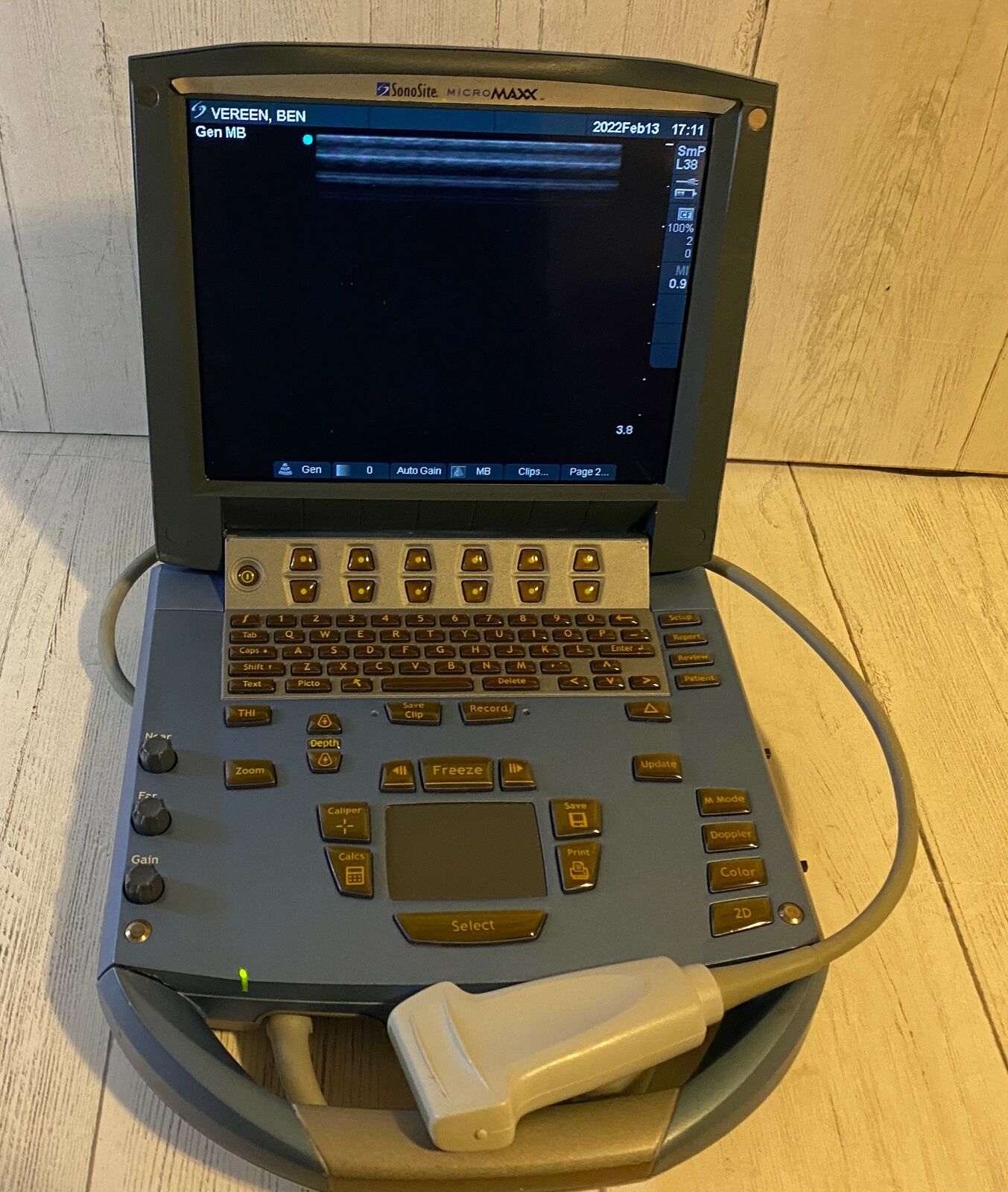 Sonosite MicroMaxx Portable Ultrasound 2008 - Main unit DIAGNOSTIC ULTRASOUND MACHINES FOR SALE