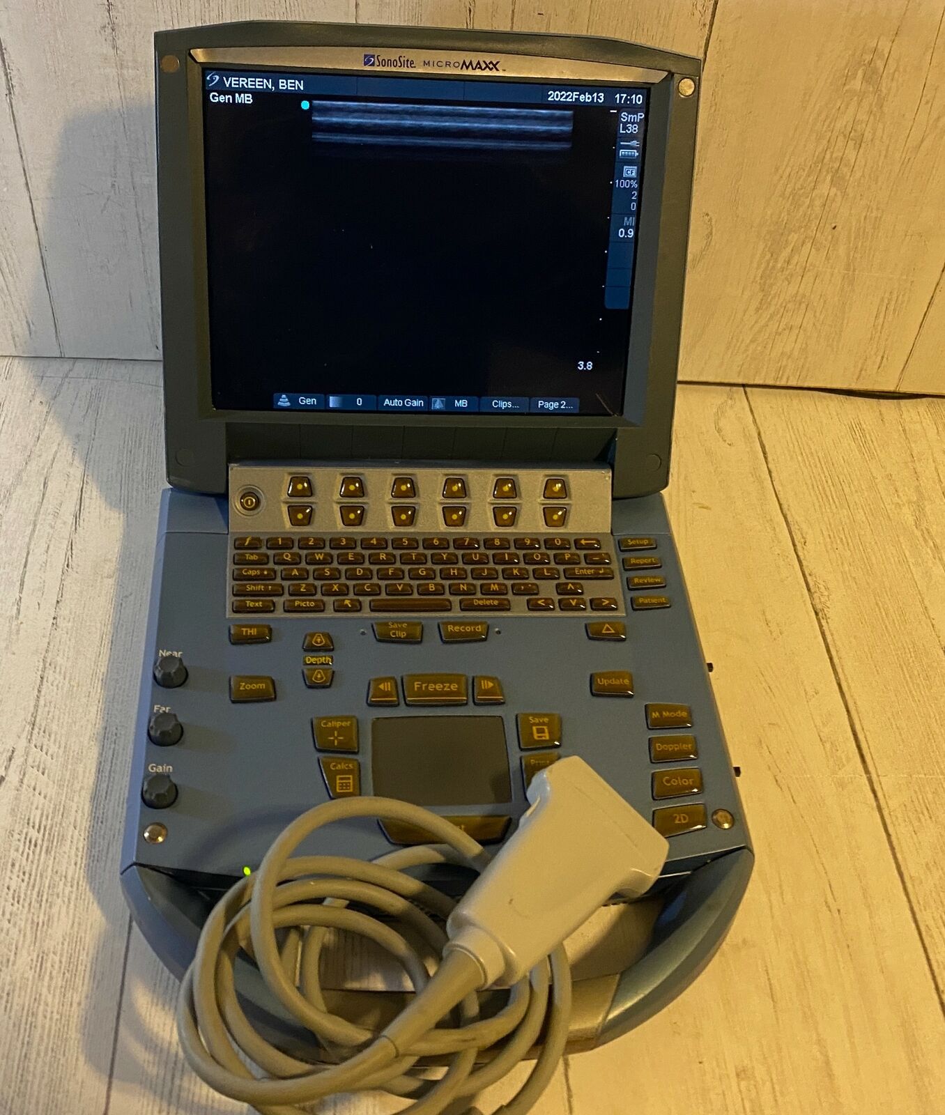Sonosite MicroMaxx Portable Ultrasound 2008 - Main unit DIAGNOSTIC ULTRASOUND MACHINES FOR SALE