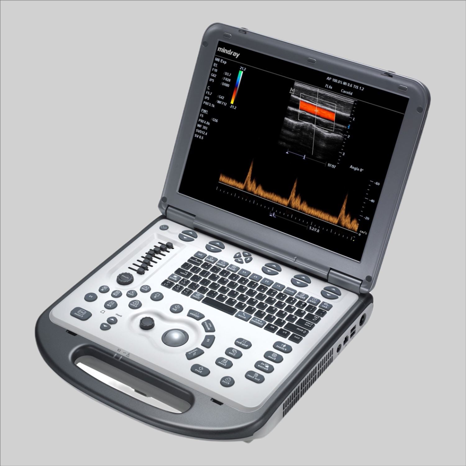 Advanced Cardiac Ultrasound Mindray M7 with one  cardiac phased array probe DIAGNOSTIC ULTRASOUND MACHINES FOR SALE