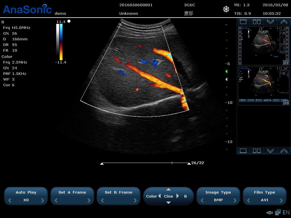 Veterinary Ultrasound Color Doppler, Quality Continuous Wave CW & Two Probes, C7 DIAGNOSTIC ULTRASOUND MACHINES FOR SALE