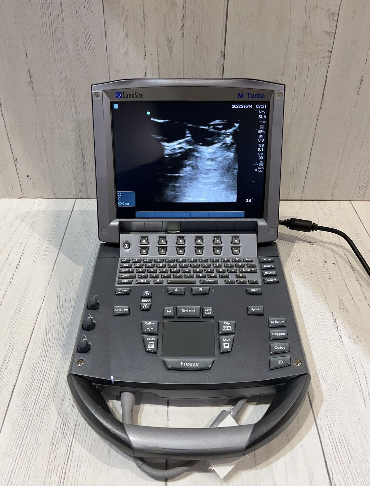 Sonosite M-Turbo Portable Ultrasound 2010 DIAGNOSTIC ULTRASOUND MACHINES FOR SALE
