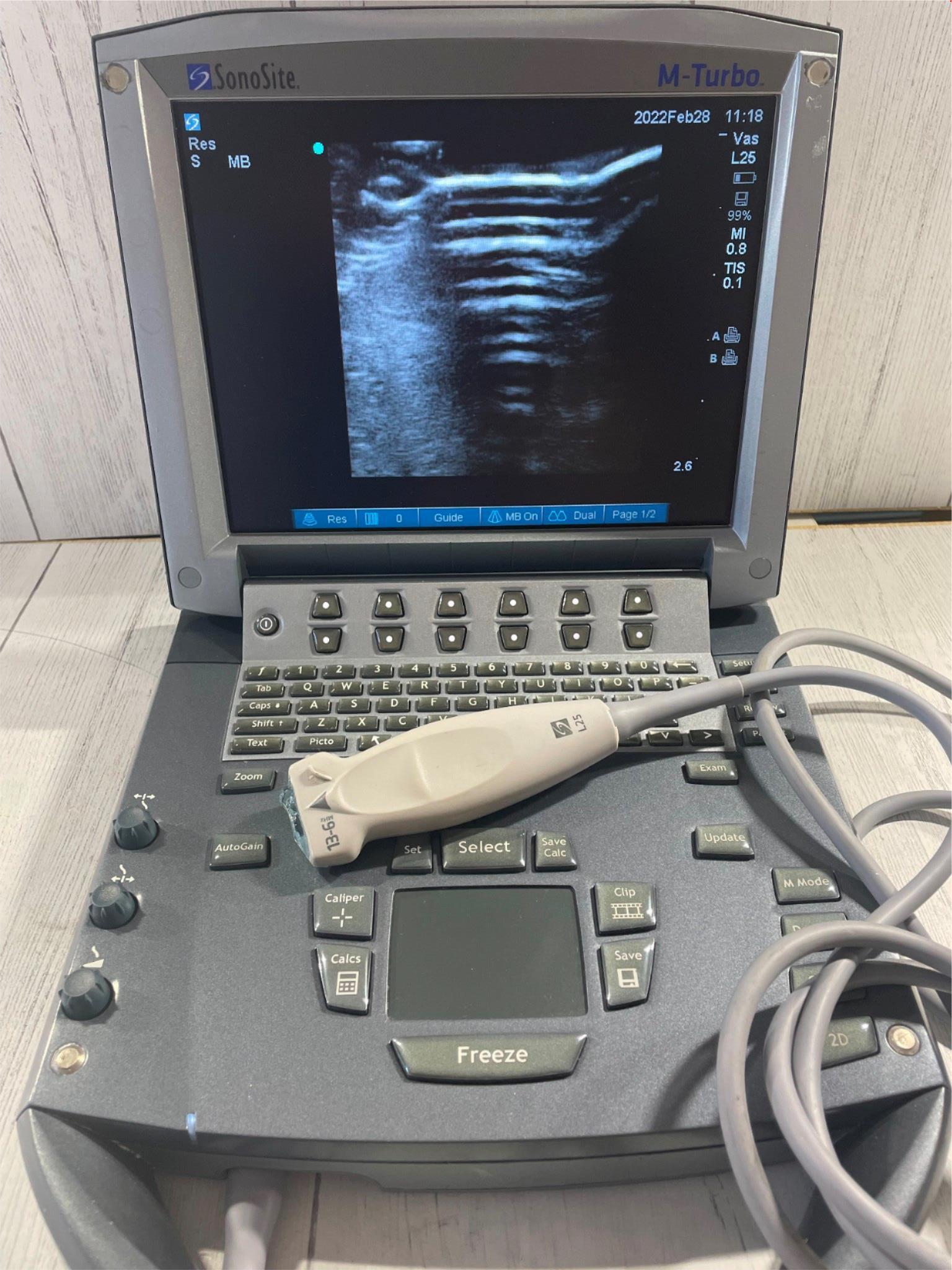Sonosite L25x Ultrasound Probe REF:P07691-70 SN:04133D For Sonosite M-Turbo DIAGNOSTIC ULTRASOUND MACHINES FOR SALE