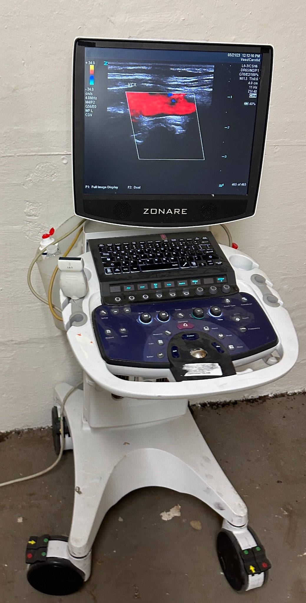 ZONARE ZS 3 Ultrasound Scanner Machine  2014 DIAGNOSTIC ULTRASOUND MACHINES FOR SALE