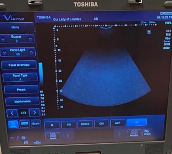 Convex, Abdominal Ultrasund Probe,Transducer TOSHIBA PVT-375ST For Viamo DIAGNOSTIC ULTRASOUND MACHINES FOR SALE