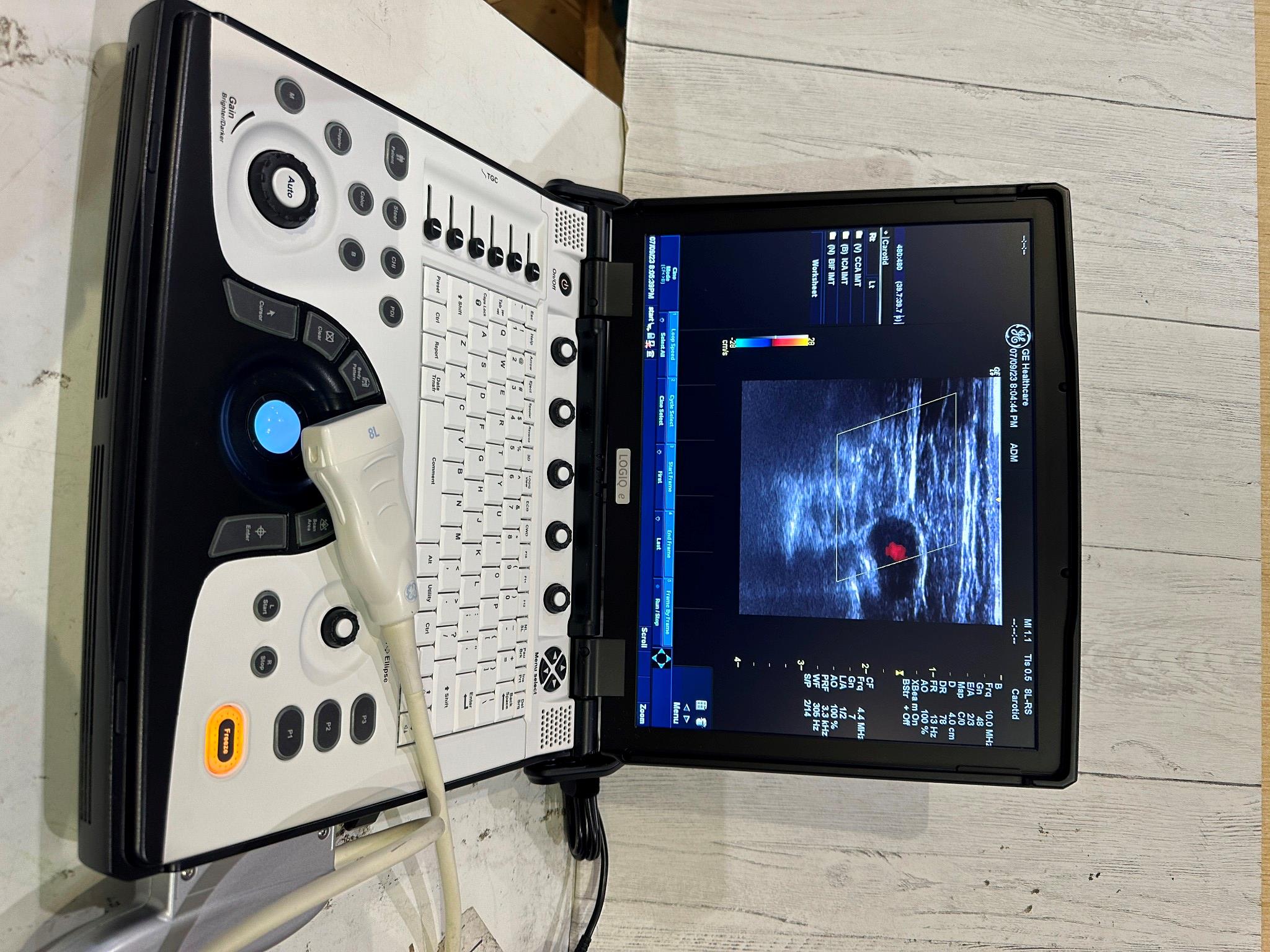 BT12 GE LOGIQ E Next Ge Ultrasound DOM 2016 DIAGNOSTIC ULTRASOUND MACHINES FOR SALE