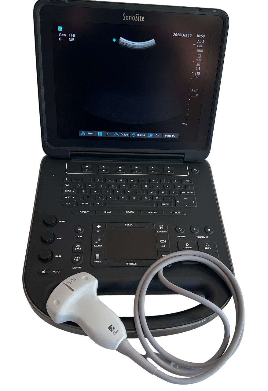 Sonosite Edge II Ultrasound 2017/Color Package DICOM, with rC60Xi Probe DIAGNOSTIC ULTRASOUND MACHINES FOR SALE