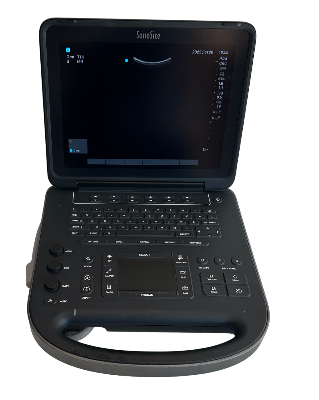 Sonosite Edge II Ultrasound 2017/Color, DICOM, with Two Probes L38xi & rC60Xi DIAGNOSTIC ULTRASOUND MACHINES FOR SALE