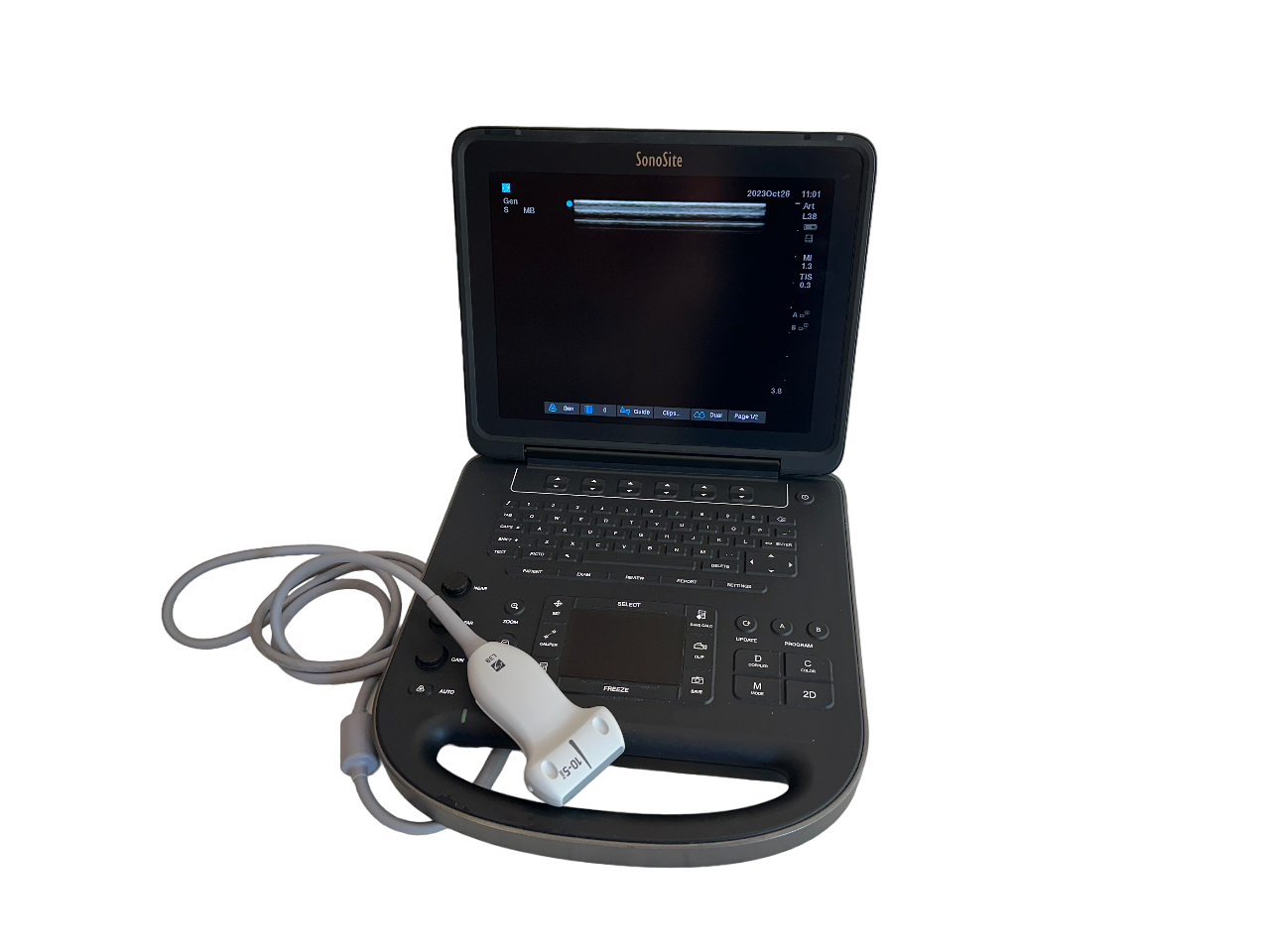 Sonosite Edge II Ultrasound 2017/Color Package DICOM, with L38xi Probe DIAGNOSTIC ULTRASOUND MACHINES FOR SALE