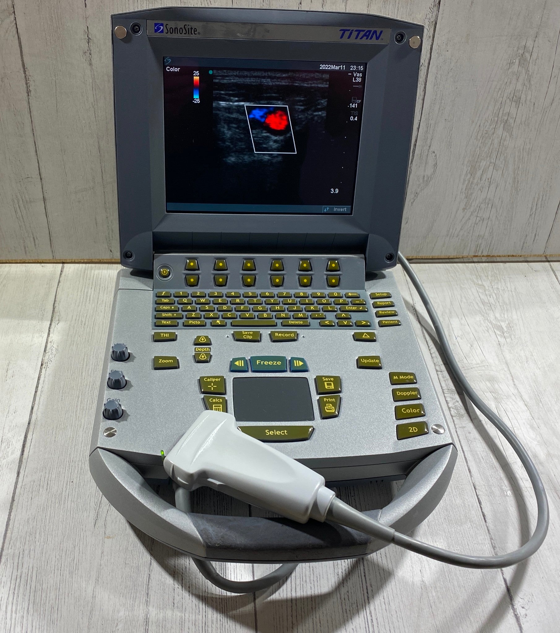 Sonosite Titan  Portable Ultrasound 2005 - With Linear Array probe L25 Probe DIAGNOSTIC ULTRASOUND MACHINES FOR SALE