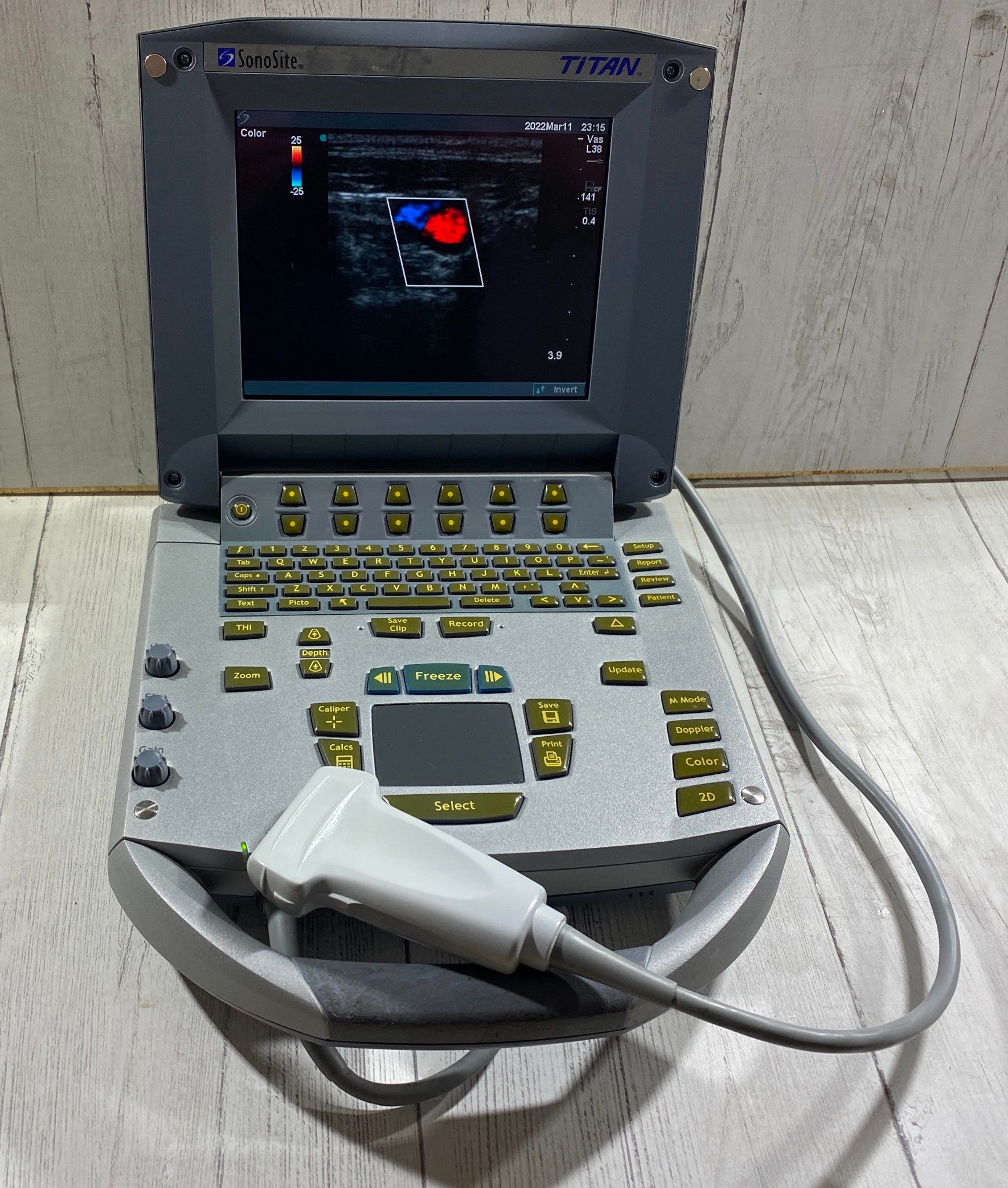 Sonosite Titan  Portable Ultrasound 2005 - With Linear Array probe L25 Probe DIAGNOSTIC ULTRASOUND MACHINES FOR SALE