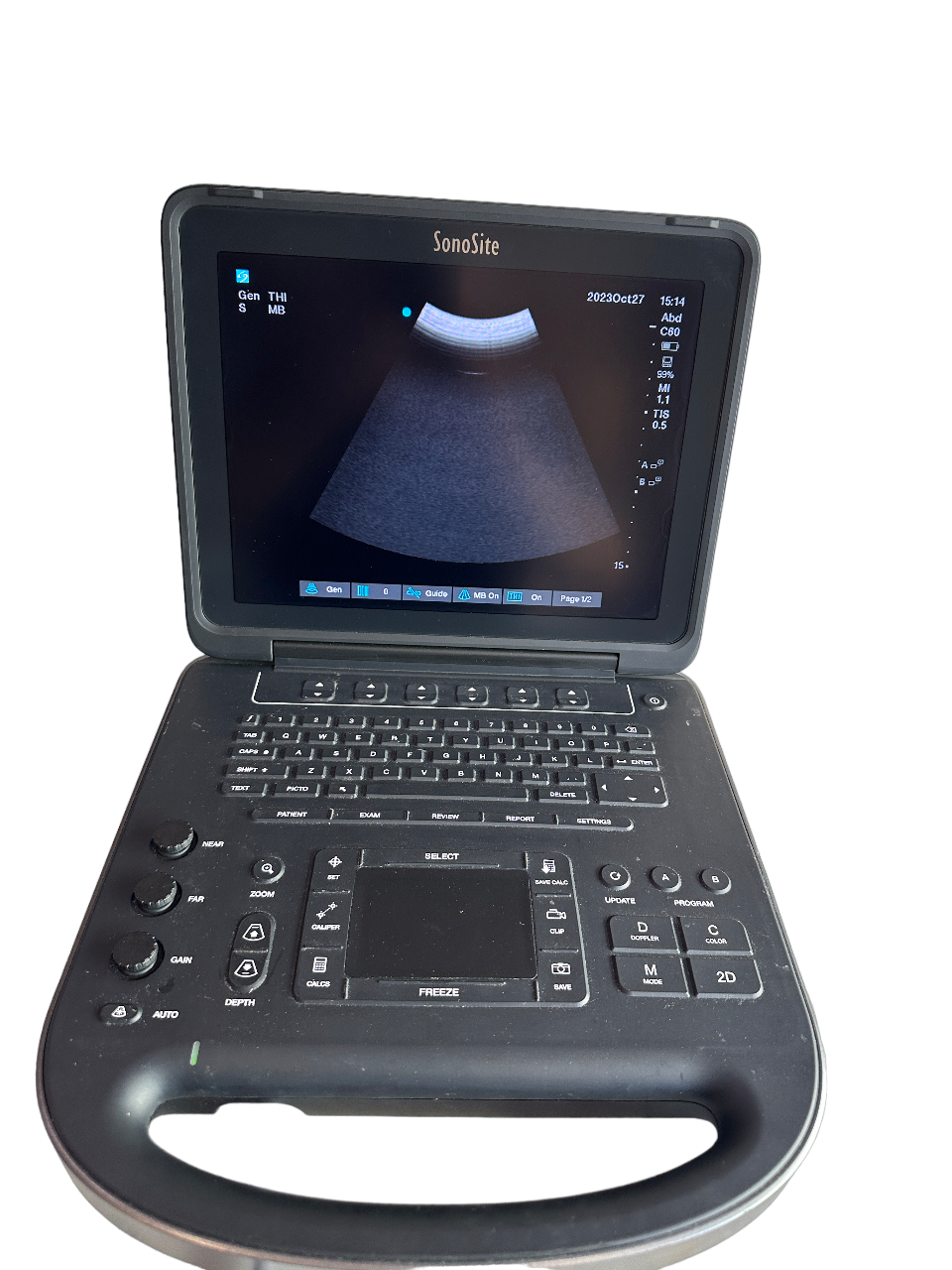 Sonosite Edge II Ultrasound 2017, DICOM & 3 Probes L38xi &rC60Xi rP19x Cart DIAGNOSTIC ULTRASOUND MACHINES FOR SALE