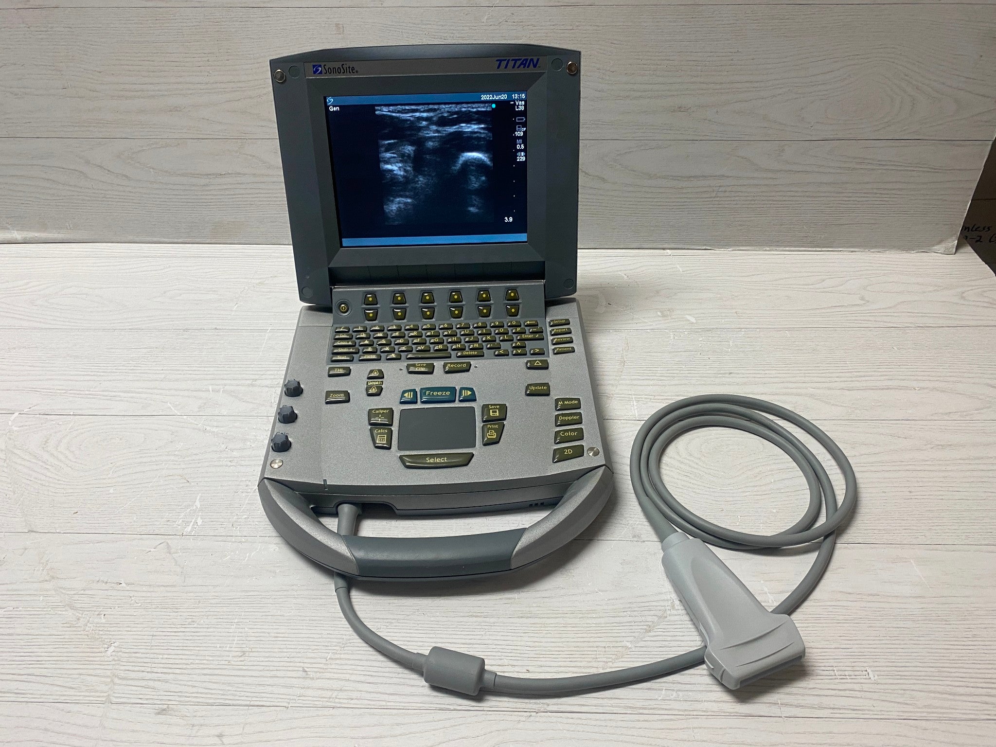 Sonosite Titan Portable Ultrasound -With Linear Array L38 and Convex C60 probes DIAGNOSTIC ULTRASOUND MACHINES FOR SALE